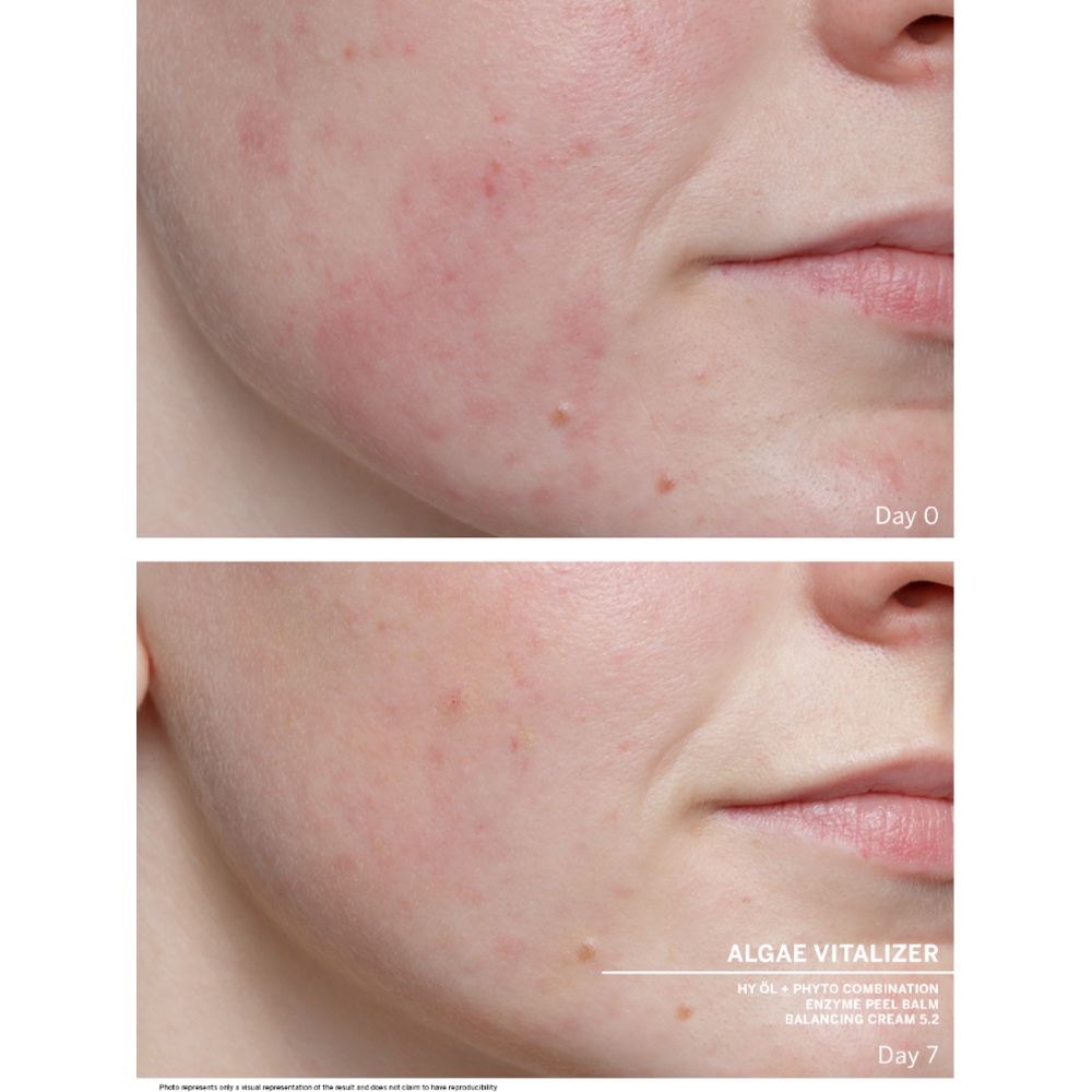 Algae Vitalizer Ampoules, 7x2ml