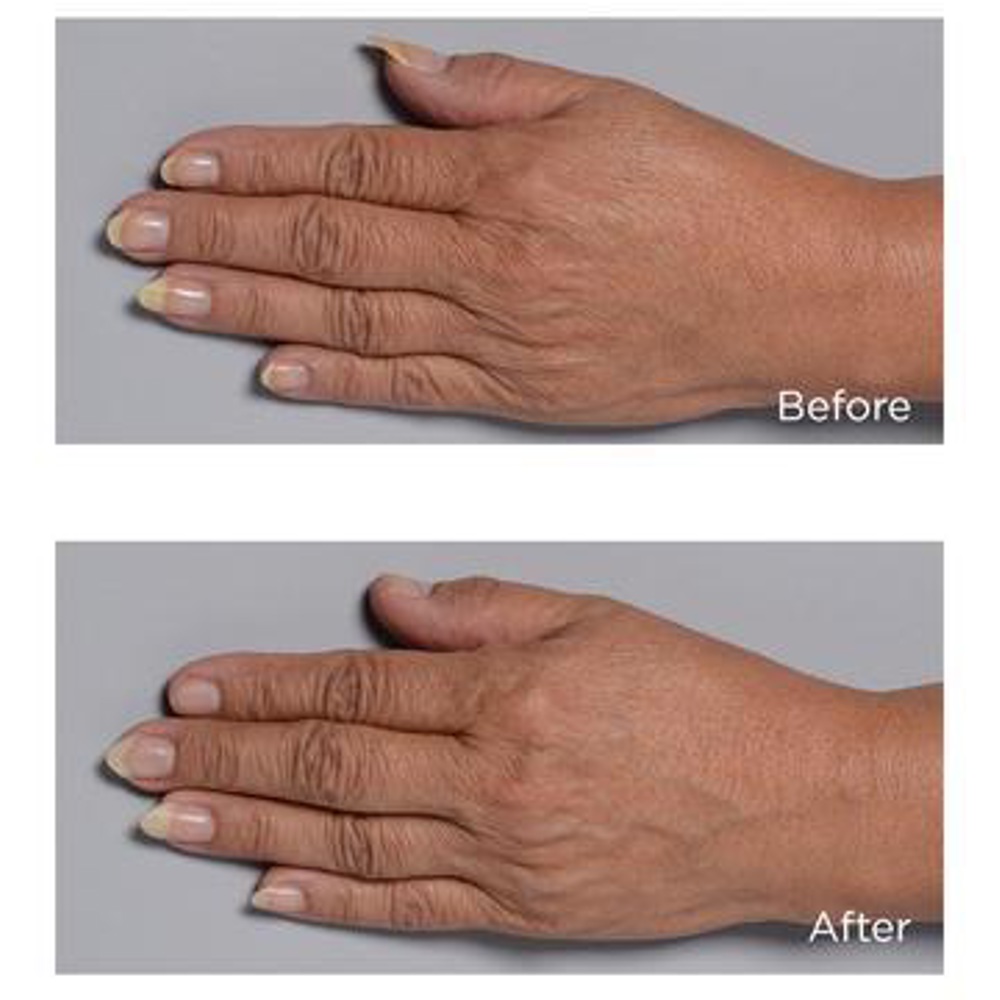 Cold Plasma+ Hand Therapy, 59ml