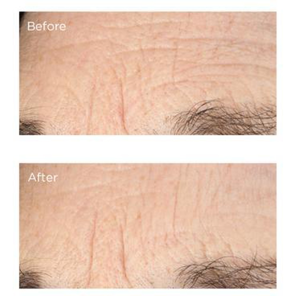 Essential FX Deep Crease Serum, 30ml