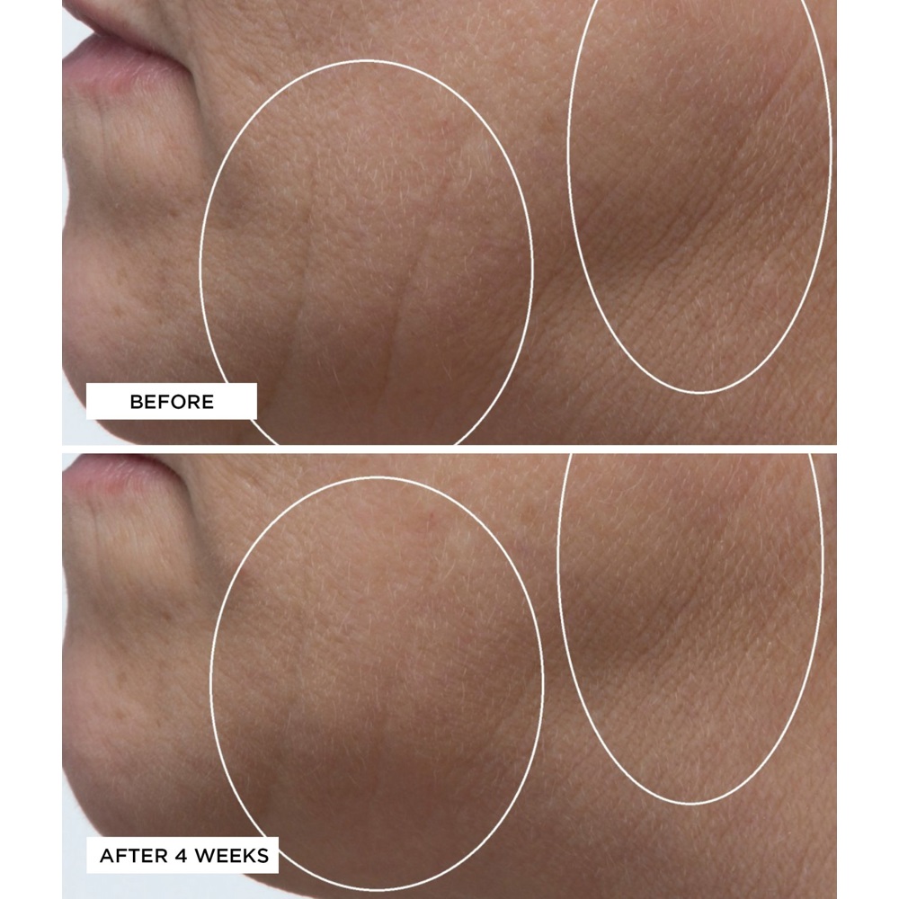 High Potency Hyaluronic Intensive Moisturizer, 30ml