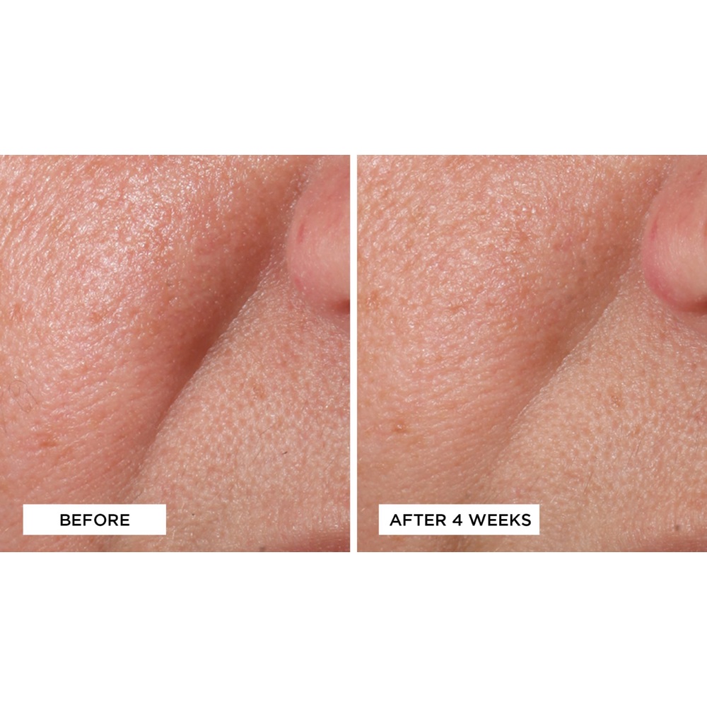 Cold Plasma+ Advanced Serum Concentrate, 30ml