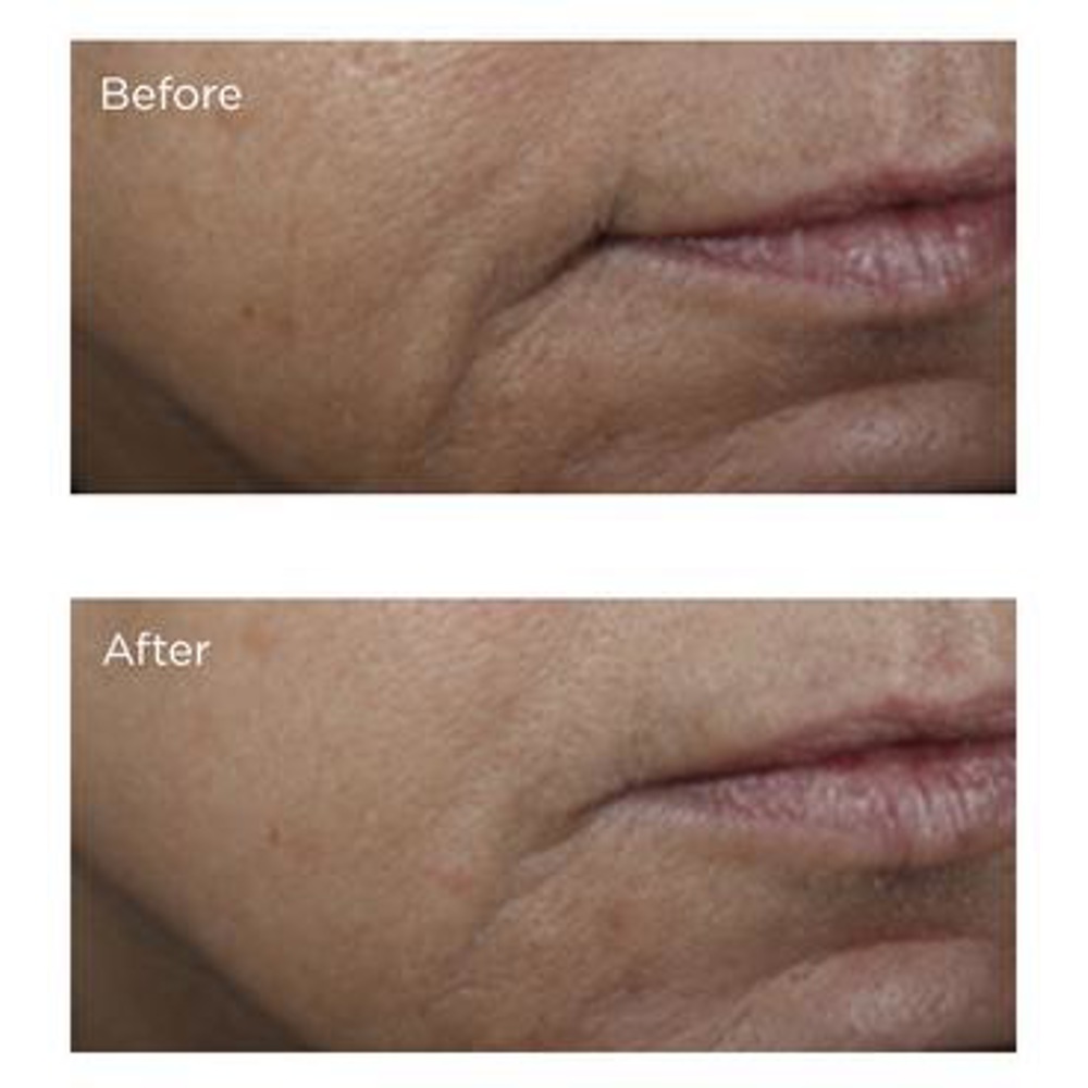 Vitamin C Ester Brightening Amine Face Lift, 59ml