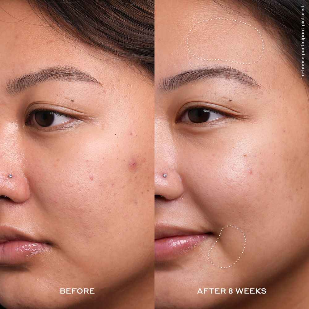 Transform Dewtopia 20% Acid Treatment