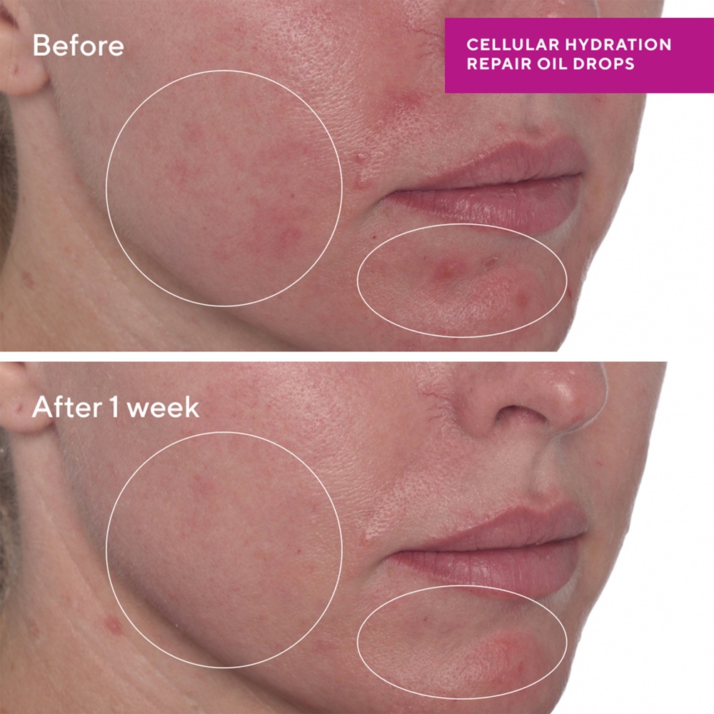 Cellular Hydration Repair Oil Drops, 30ml