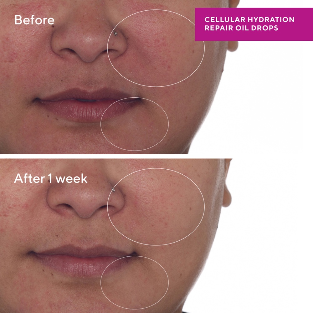 Cellular Hydration Repair Oil Drops, 30ml