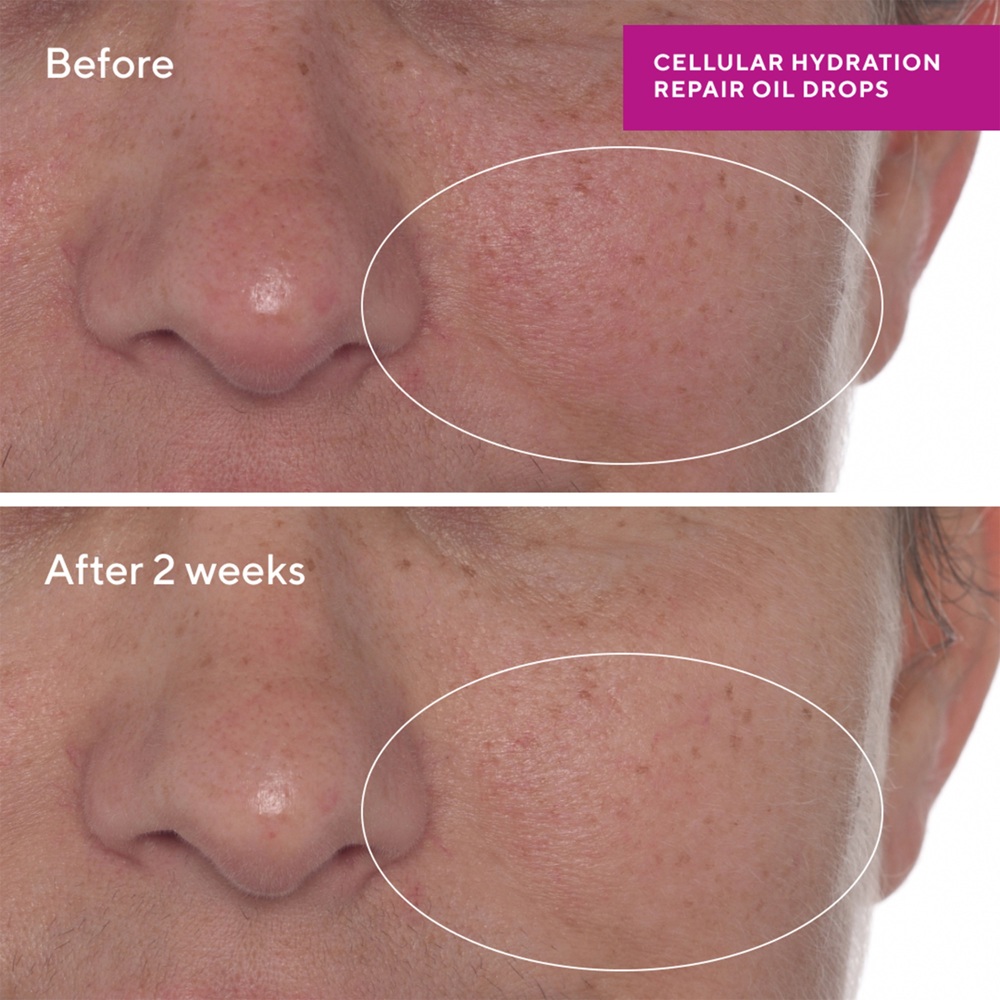 Cellular Hydration Repair Oil Drops, 30ml