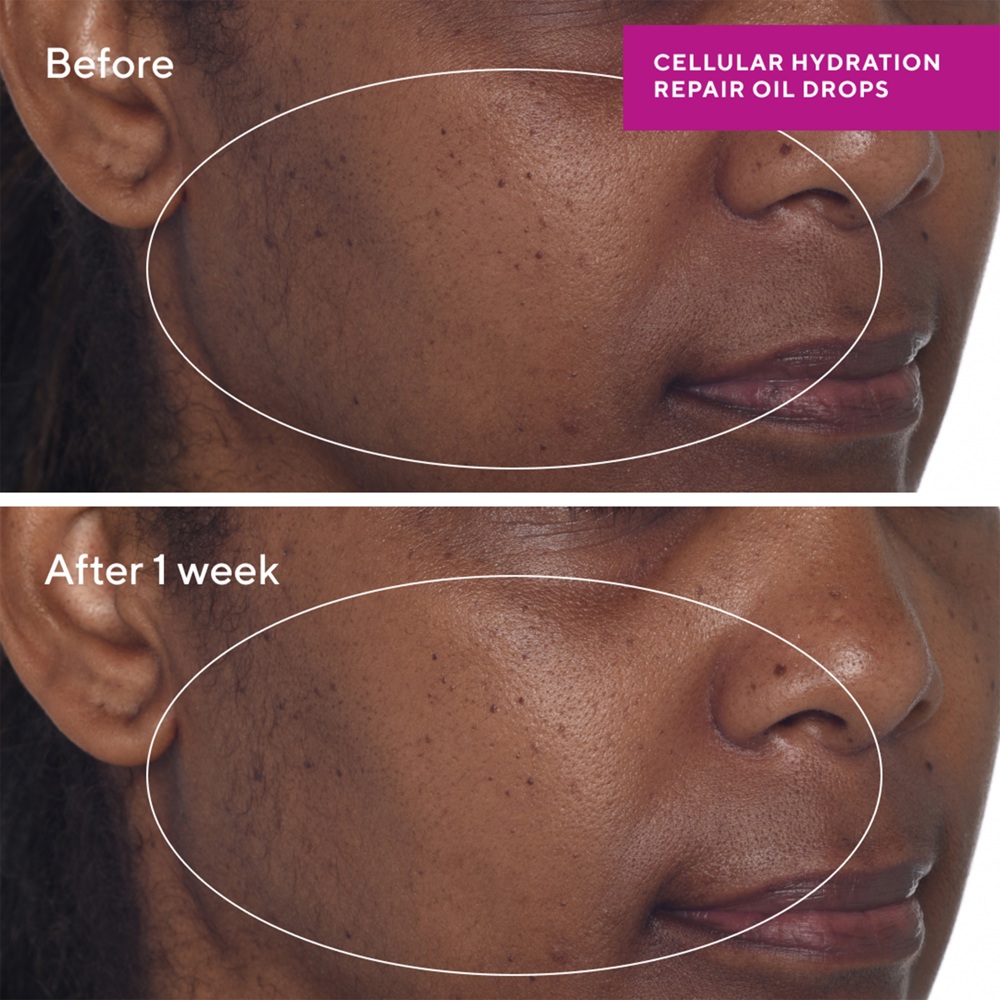 Cellular Hydration Repair Oil Drops, 30ml