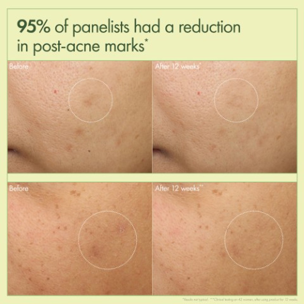 Dr. Weil Mega-Mushroom Dark Spot Correcting Brightening Moisturizer, 50ml