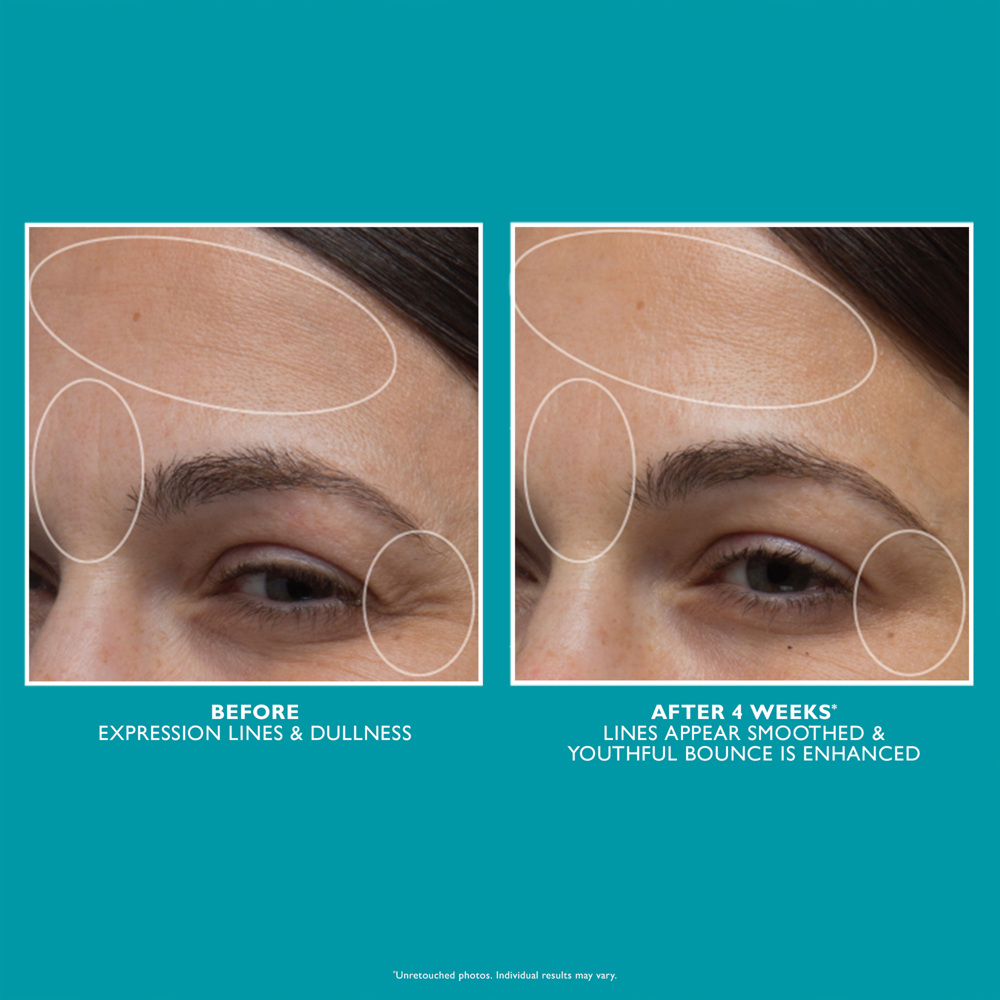 Peptide Skinjection™ Moisture Infusion Cream, 50ml