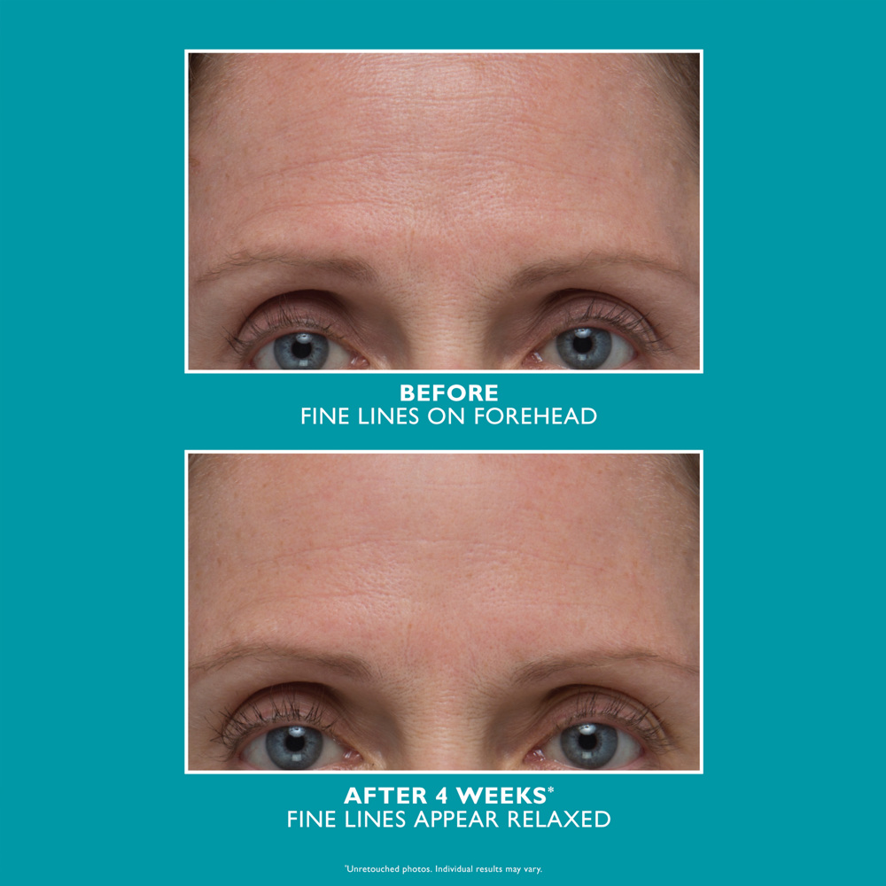 Peptide Skinjection™ Amplified Wrinkle-Fix Serum, 30ml