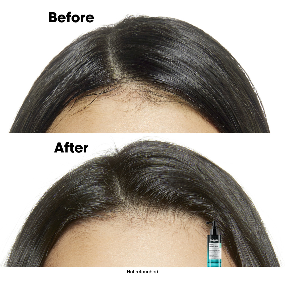 Scalp Advanced Anti-Discomfort Shampoo
