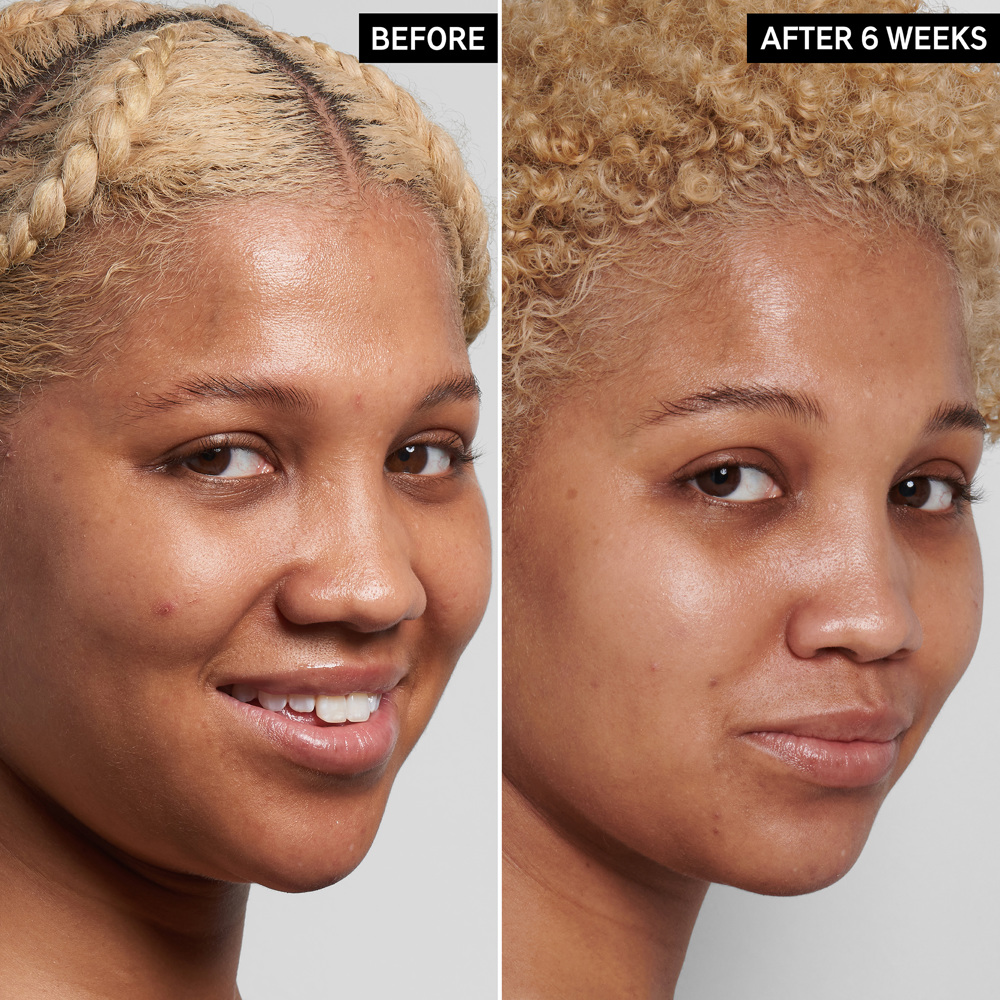 Niacinamide Serum, 30ml