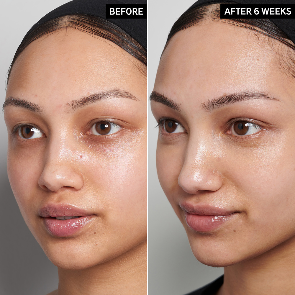 15% Vitamin C and EGF Serum, 30ml