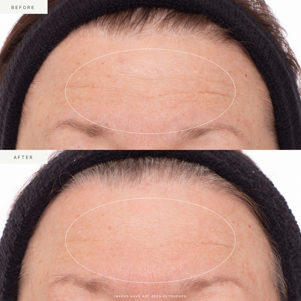 Plant Stem Cell Retinol Alternative Serum