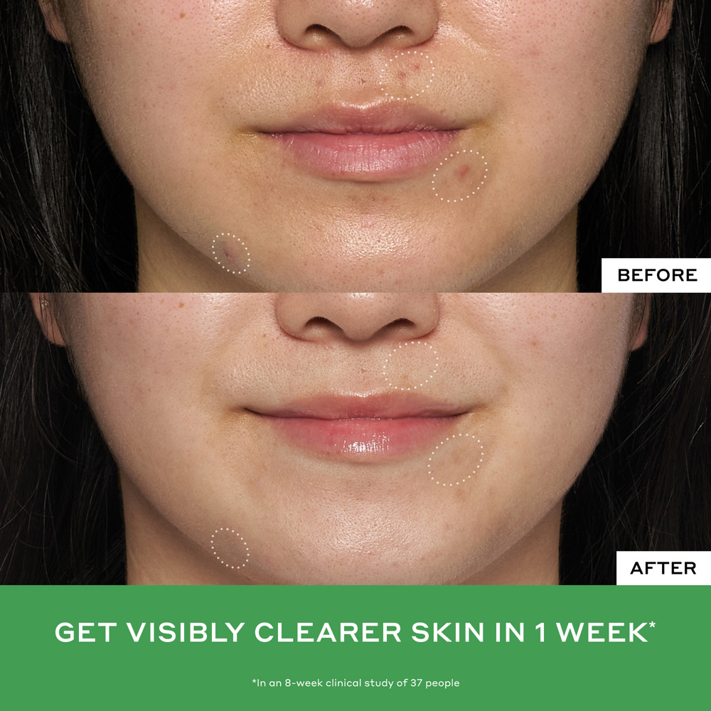 Detox Drops 2% Salicylic Acid Toner, 120ml