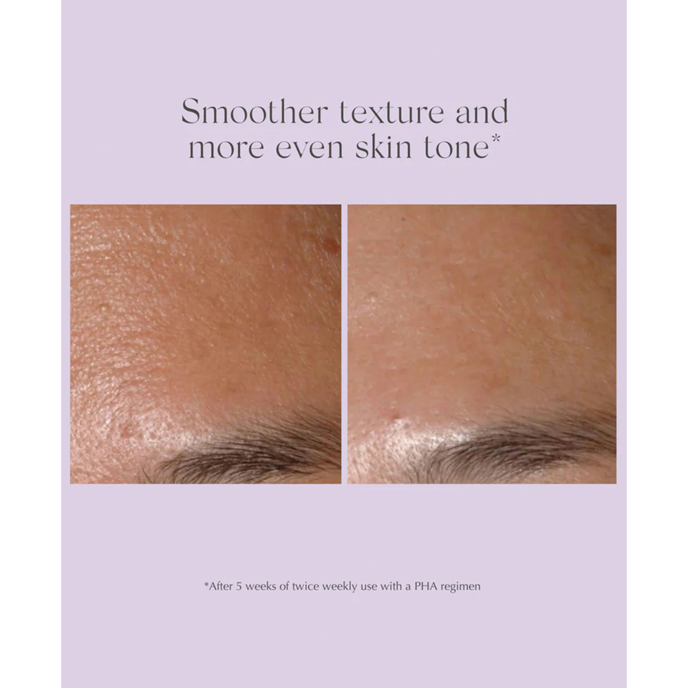 Performance Peel AP25 13 Treatments, 19,5ml