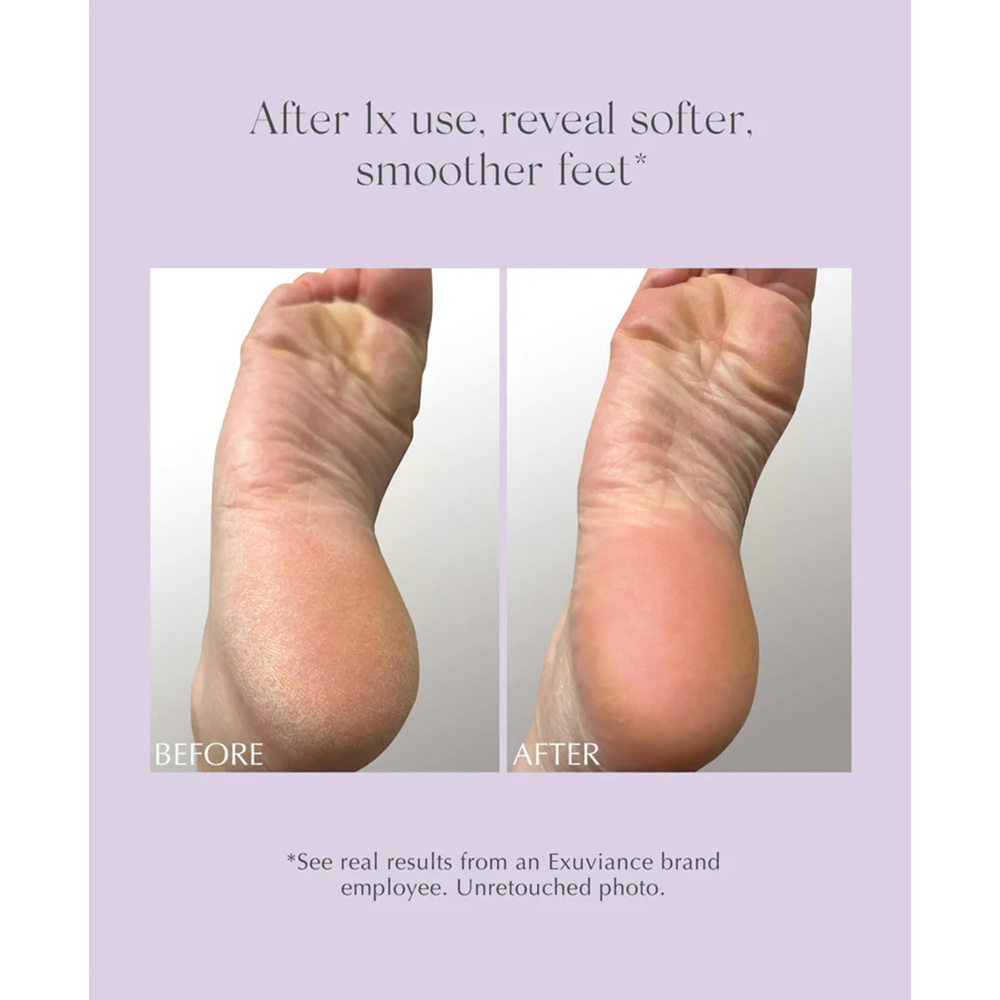 Exfoliating & Conditioning Foot Balm, 50g