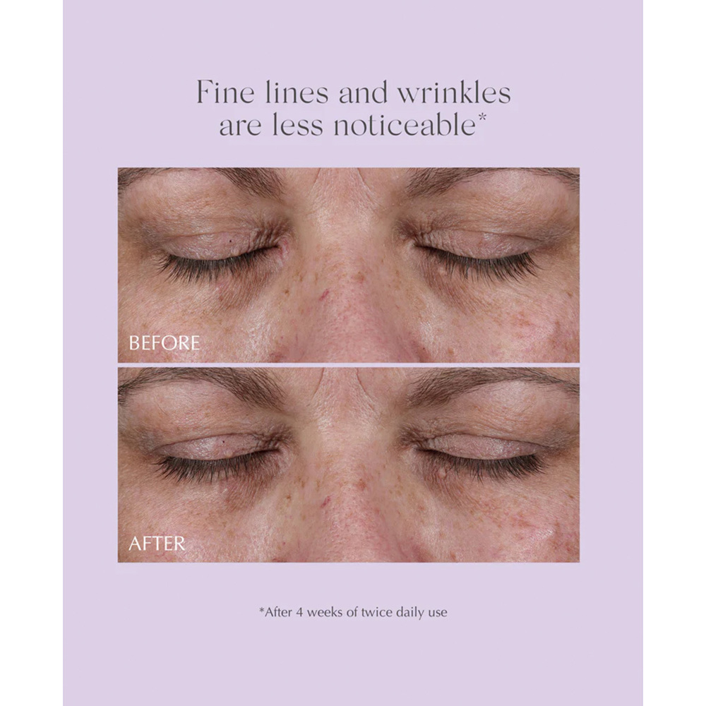 Age Reverse Total 360 Eye Contour, 15g