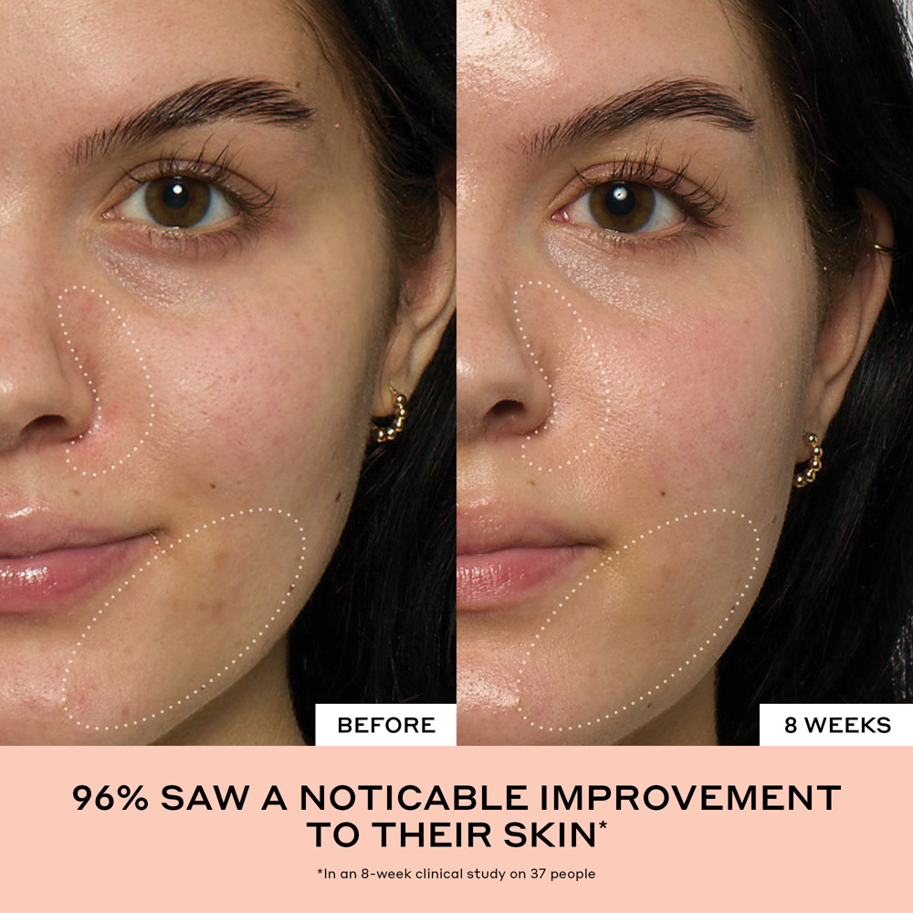 Peach Glaze Glow Niacinamide Serum, 30ml