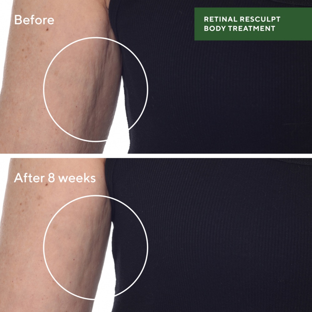Retinal ReSculpt Body Treatment, 148ml