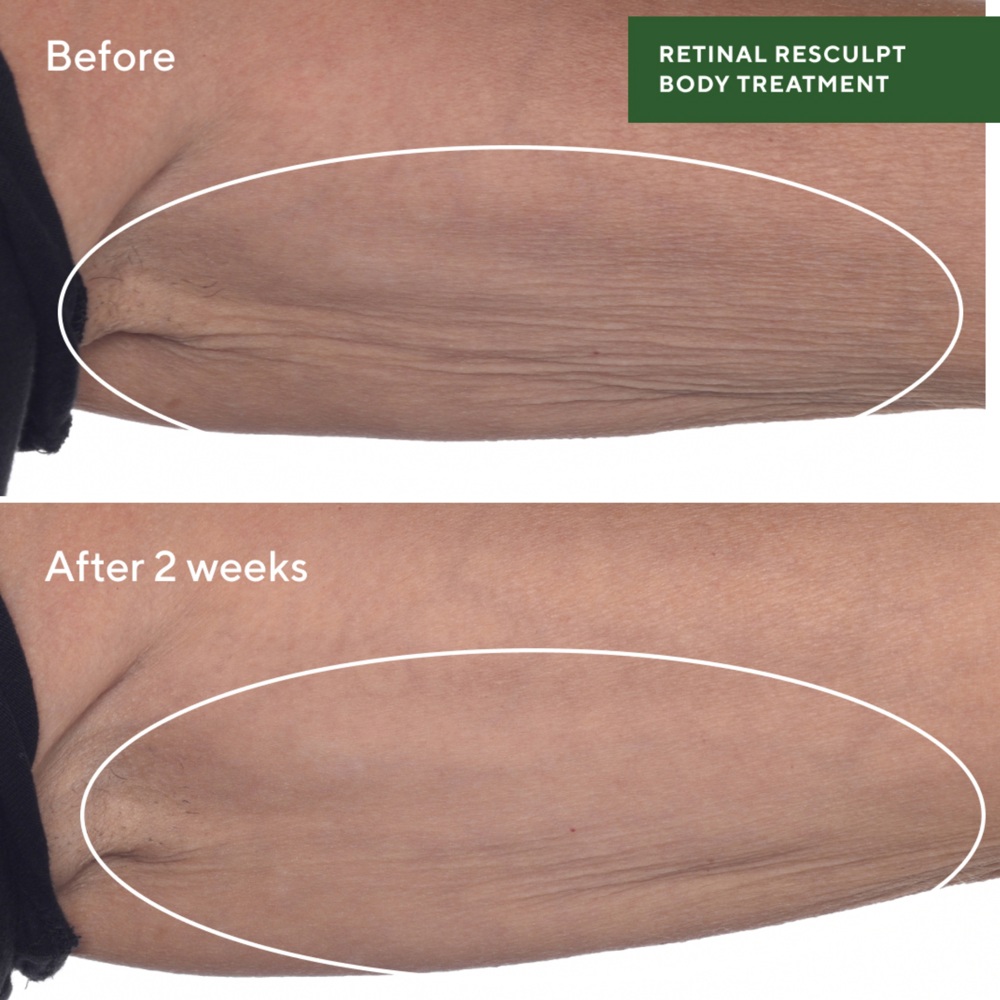 Retinal ReSculpt Body Treatment, 148ml