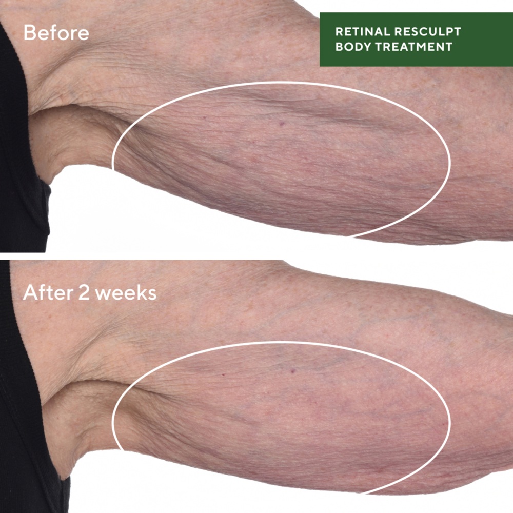 Retinal ReSculpt Body Treatment, 148ml