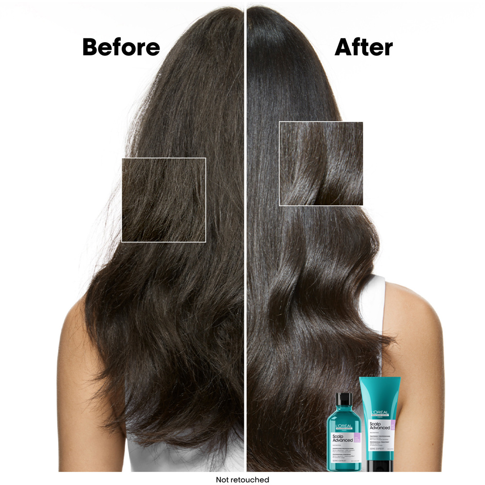 Scalp Advanced Anti-Discomfort Shampoo