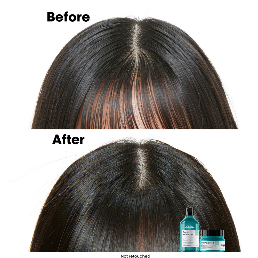 Scalp Advanced Anti-Oiliness 2-in-1 Deep Purifier Clay, 250ml