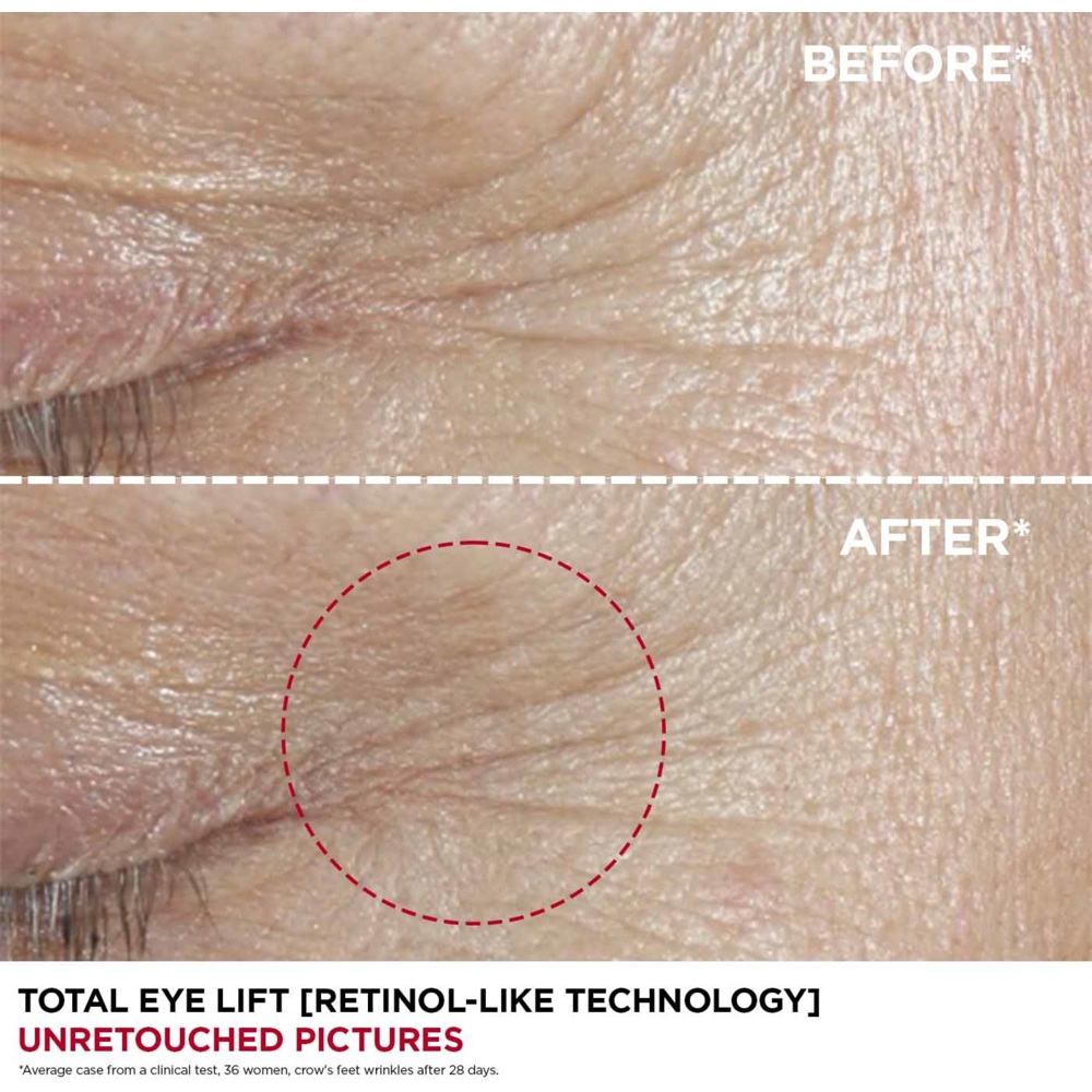 Total Eye Lift, 15ml