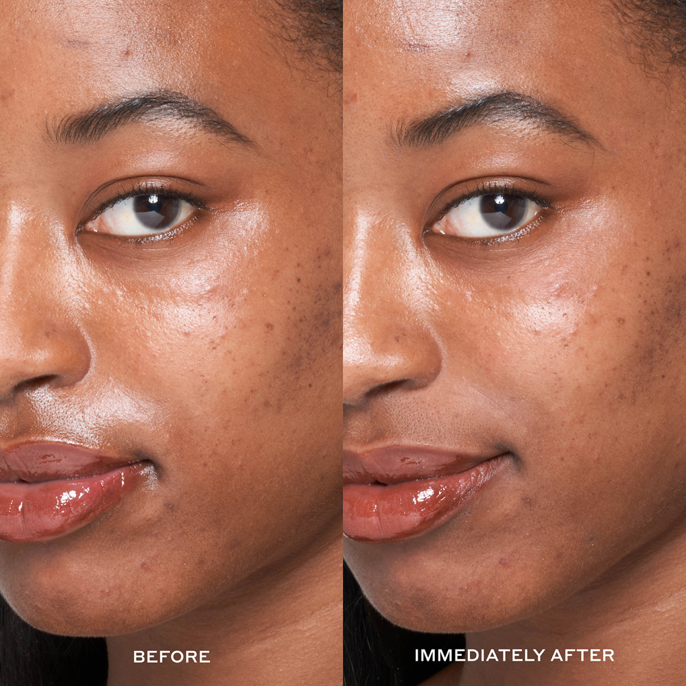 Dewtopia 25% Acid Flash Facial Mask, 50ml