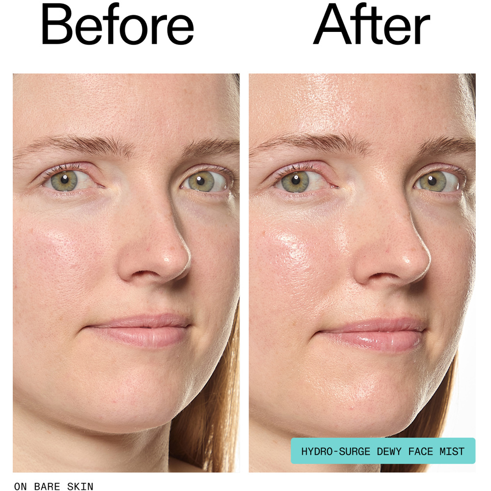 Hydro-Surge Dewy Face Mist, 75ml