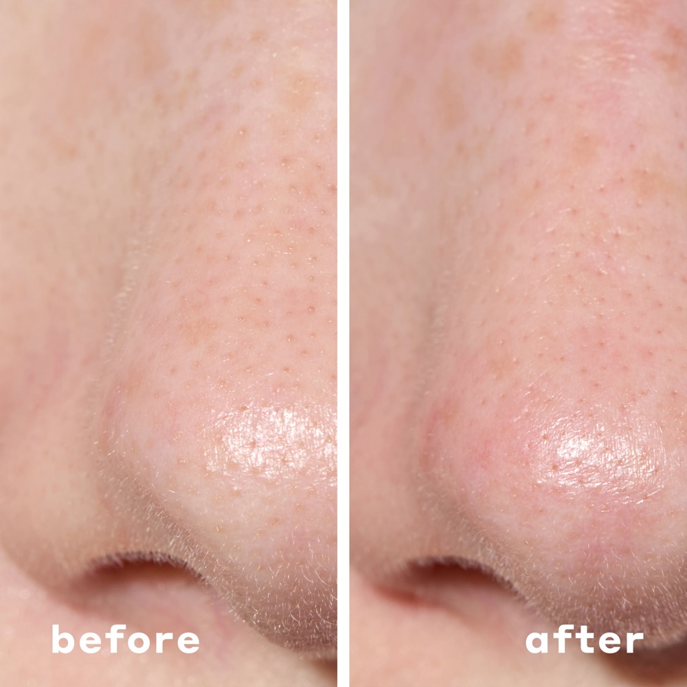 2-in-1 Deep Cleansing Pore Strip, 6 Patches