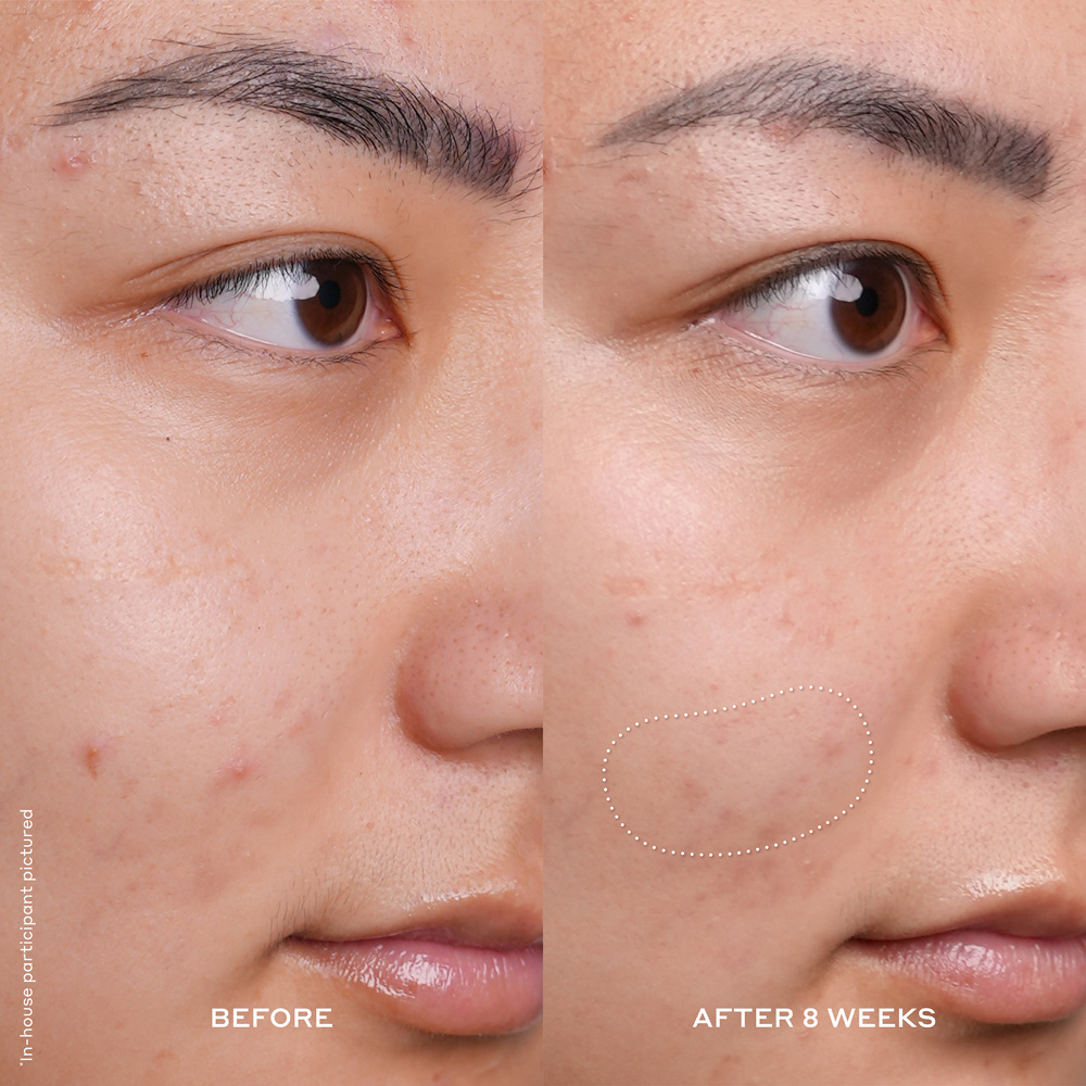 Banana Bright Vitamin C Serum, 30ml