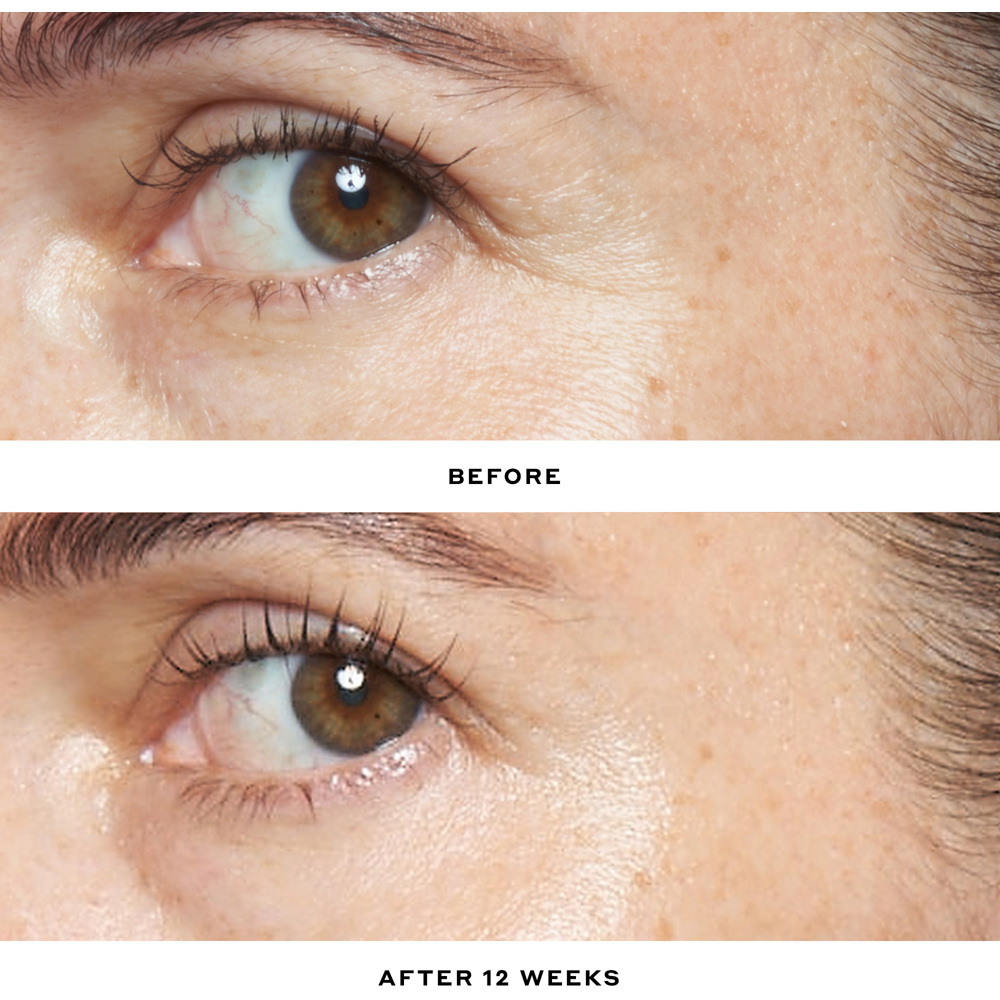 Double Rewind 0.3% Pro-Grade Retinol Serum, 30ml