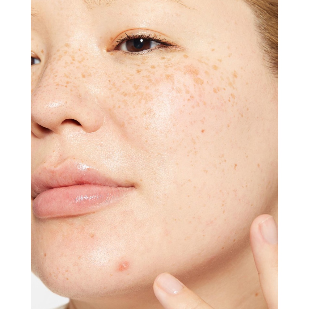 Deep Breakout Liquid Patch, 15ml