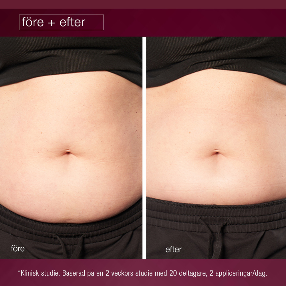 Dynamic Skin Sculptor Body Serum, 150ml