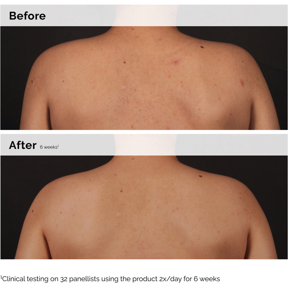 Salicylic Acid 0.5% Body serum, 240ml