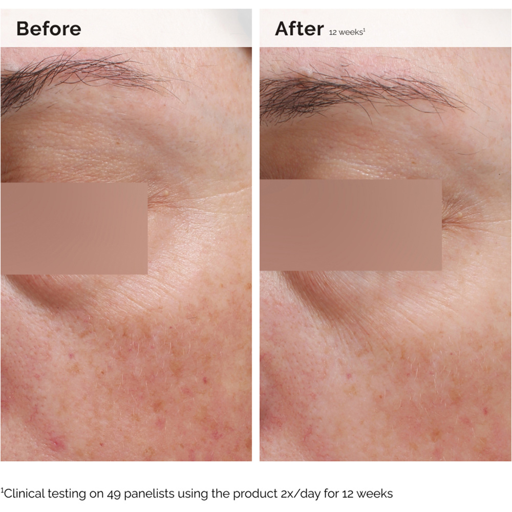 Niacinamide 5% Face and Body Emulsion, 100ml