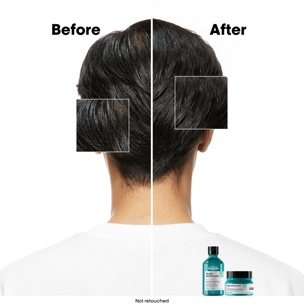 Scalp Advanced Anti-Oiliness Shampoo, 300ml