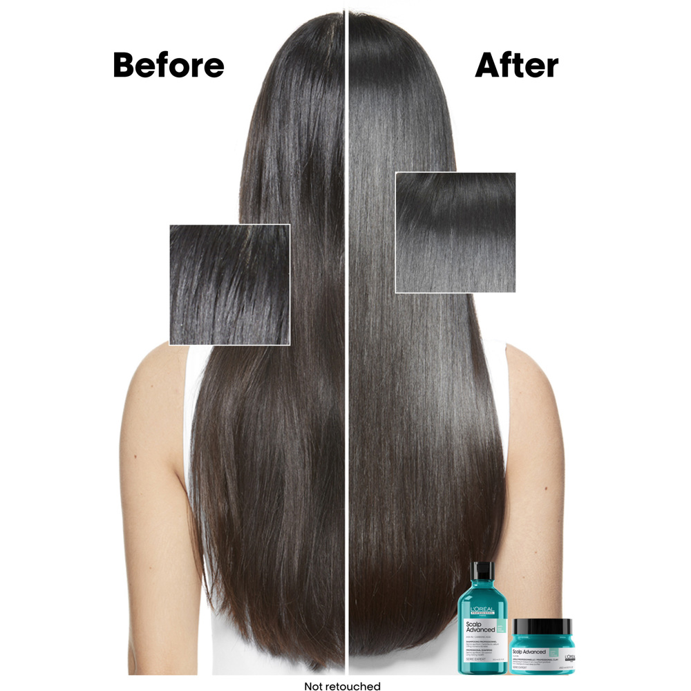 Scalp Advanced Anti-Oiliness Shampoo, 300ml