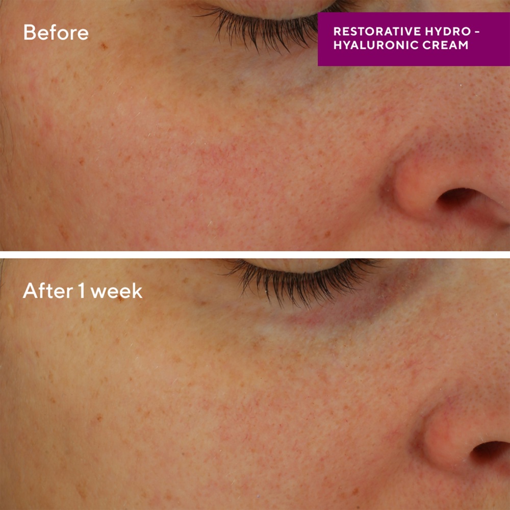 Restorative Hydro-Hyaluronic Cream, 50ml