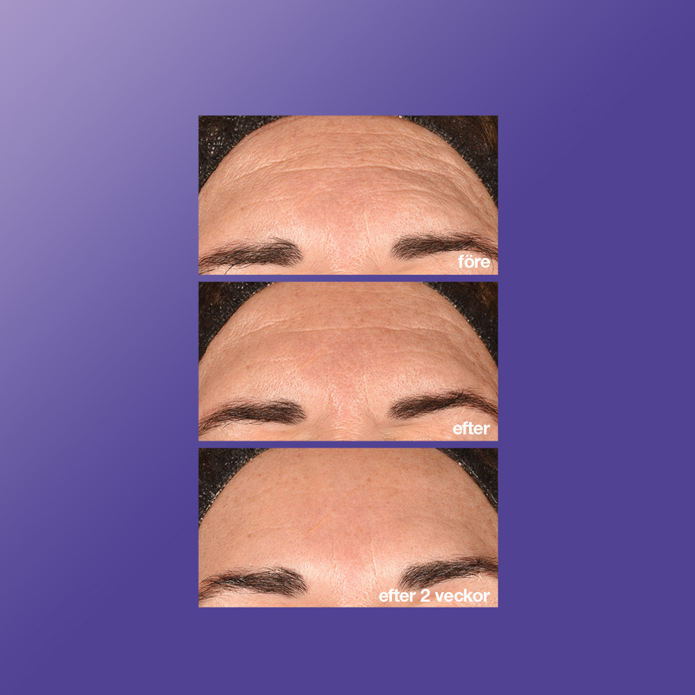 Phyto Nature E², 100ml