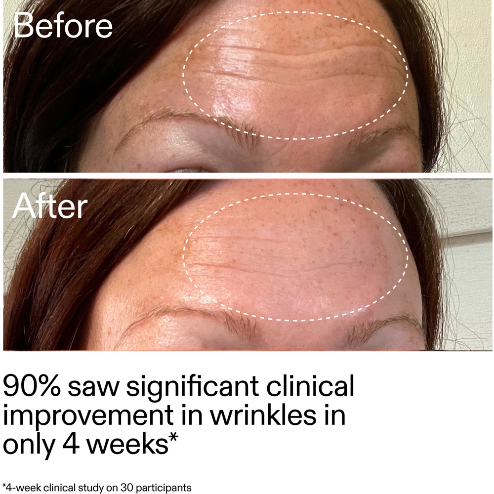 Starter Retinol Serum, 30ml