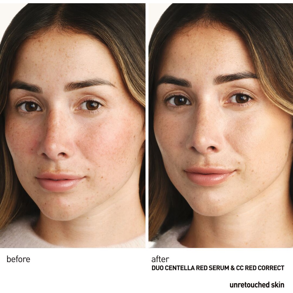 Centella Red Serum, 30ml