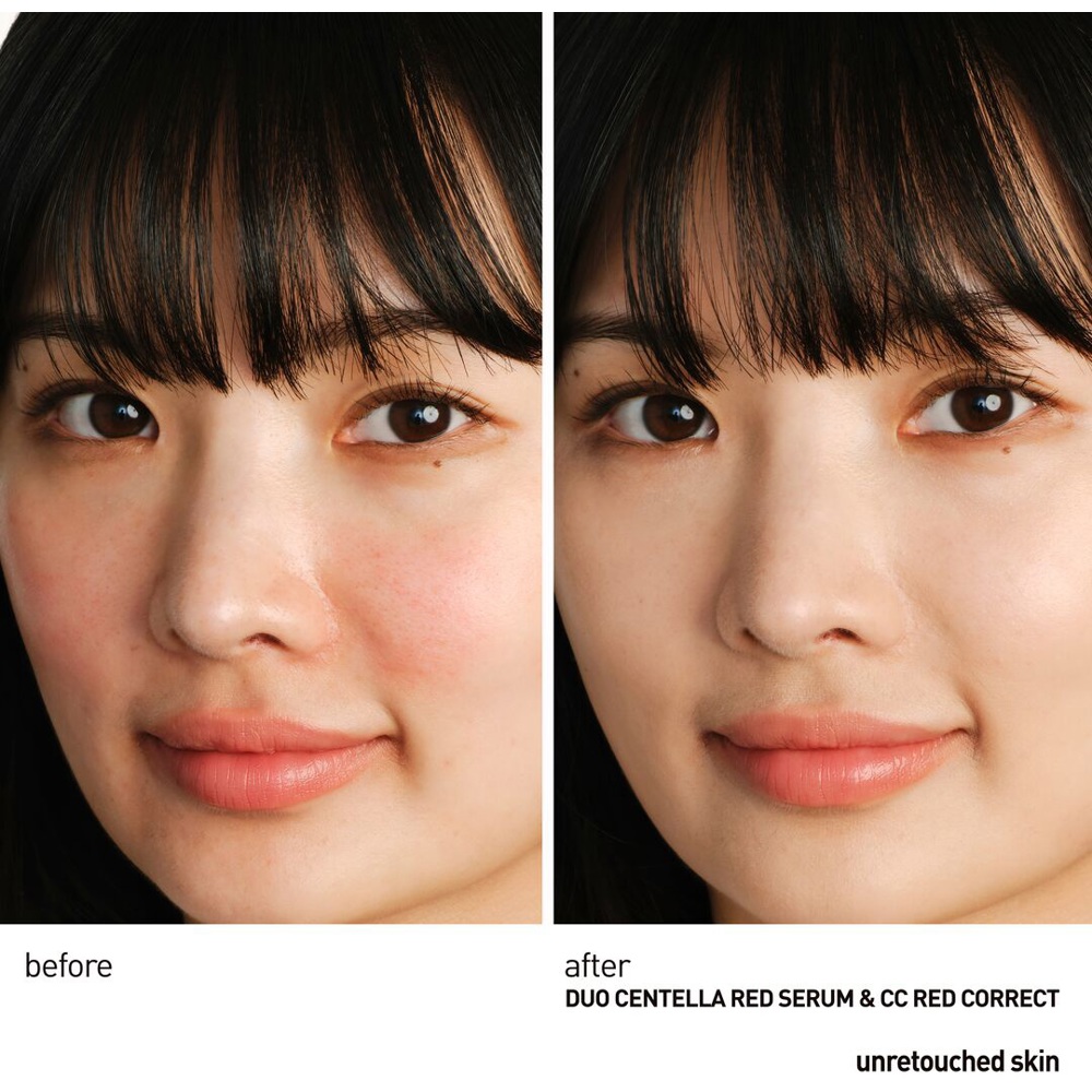 Centella Red Serum, 30ml