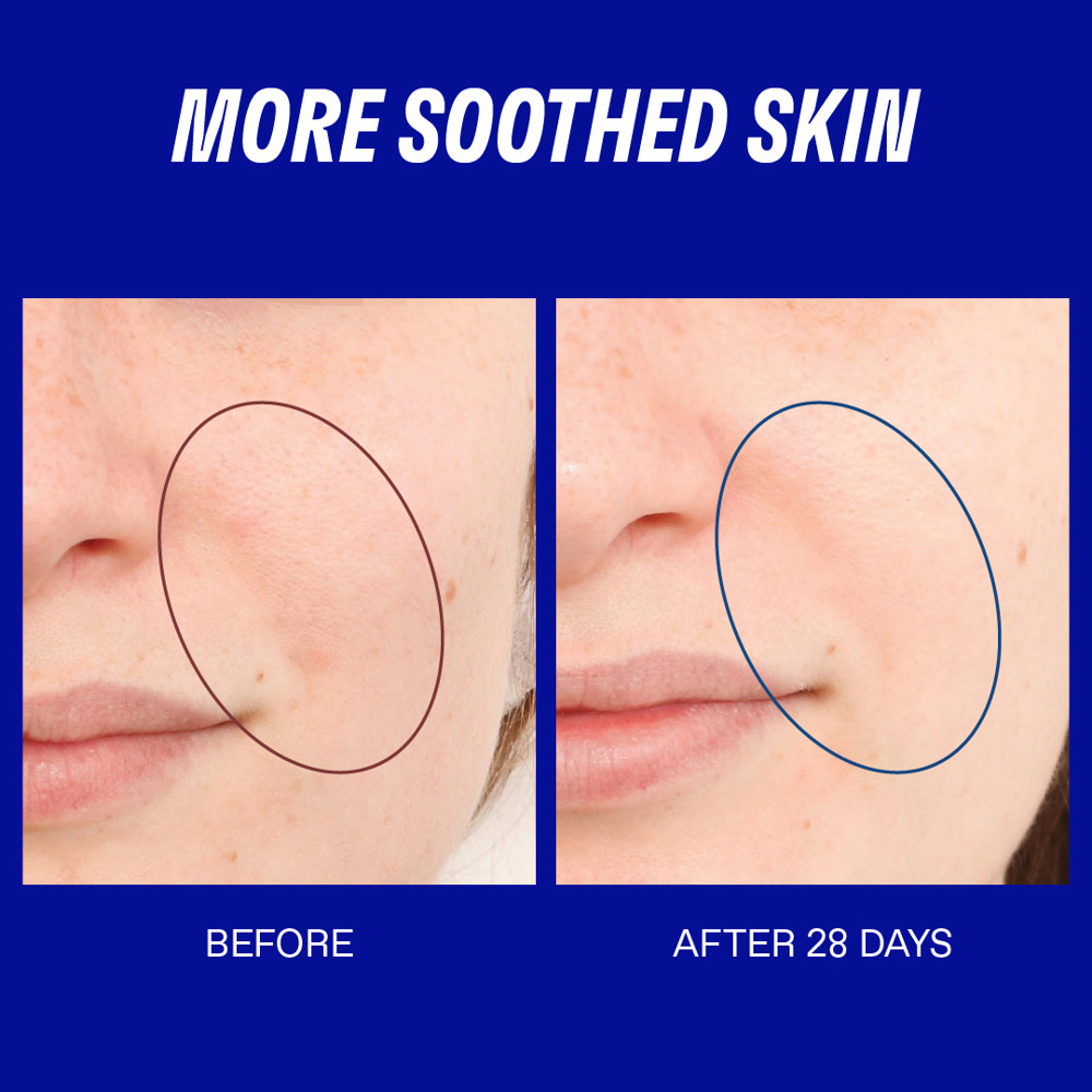 Smart Yoghurt™ Probiotic Super Serum, 30ml