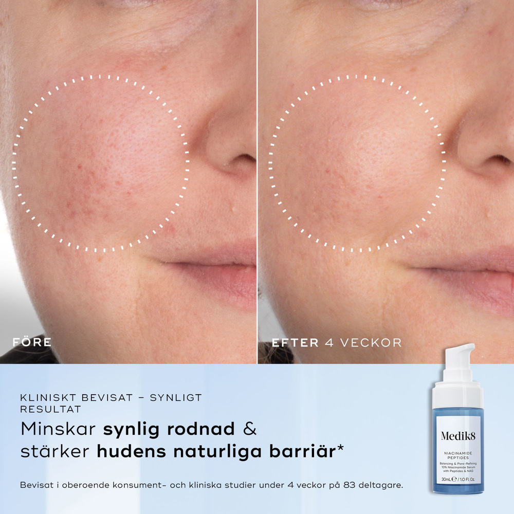 Niacinamide Peptides, 30ml