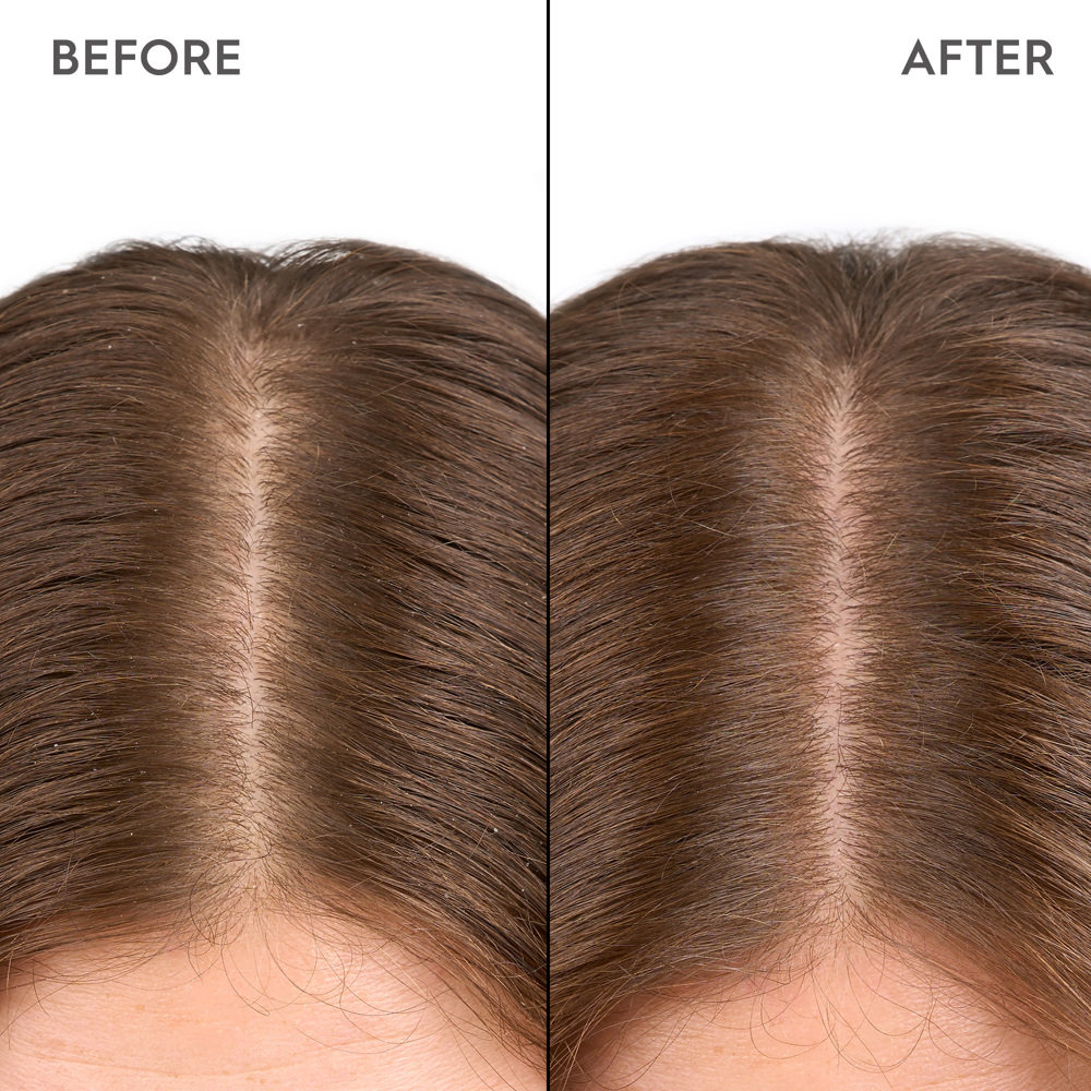 Moisturizing Scalp Drops, 100ml