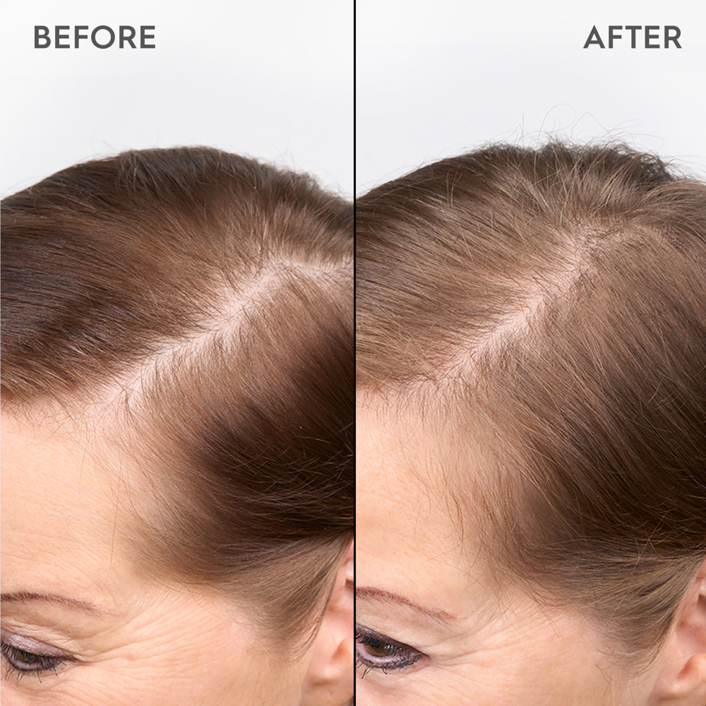 Redensifying Shampoo