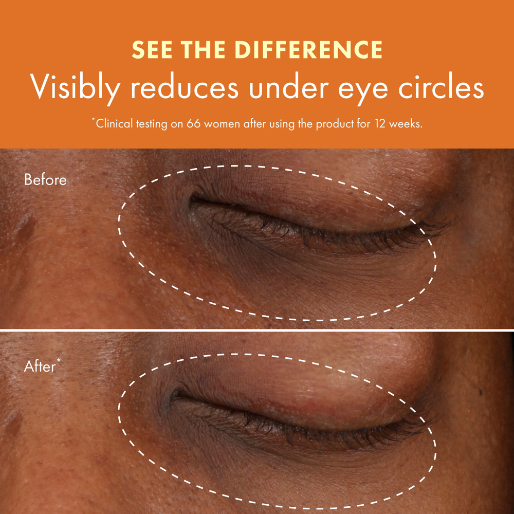 Ginzing Brightening Eye Cream, 15ml